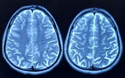 Descoperire uimitoare: Organ imunitar ascuns în craniu