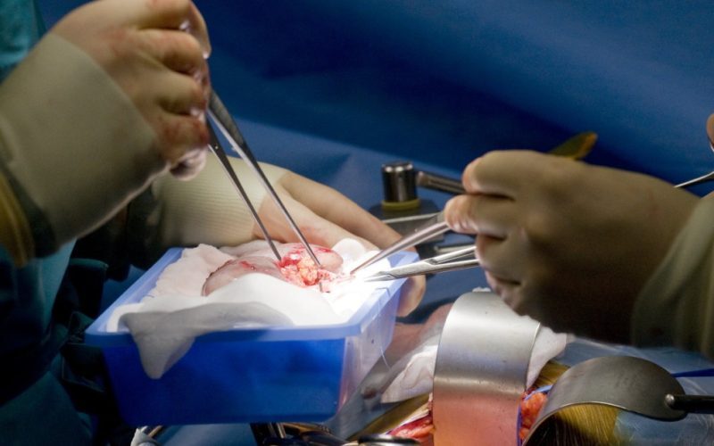 Rinichi de porc, succes record la transplant SUA