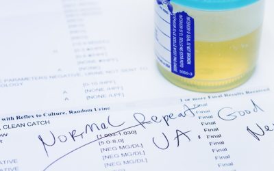 Test urină: Depistează 9 din 10 cancere vezică