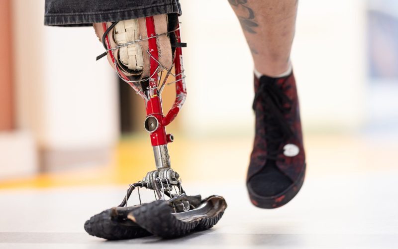 Mecanicul de biciclete, creator de proteze din piese de metal